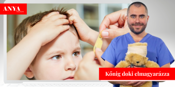 Miért nő dudor a gyerek fején? Eddig talán te sem tudtad