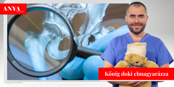 Így beszéljünk a csontjainkról a gyerekeknek!