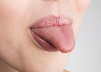 Halálos betegséget jelezhet a nyelv színe – cikkajánló: www.noklapja.hu