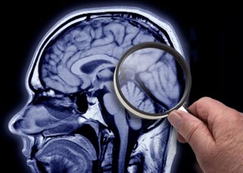 Két szakma csökkentheti az Alzheimer kockázatát – cikkajánló: www.noklapja.hu