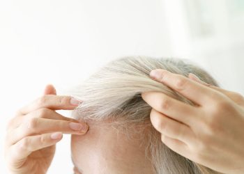 Egy népszerű fogyókúra kopaszodást okozhat – cikkajánló: www.noklapja.hu